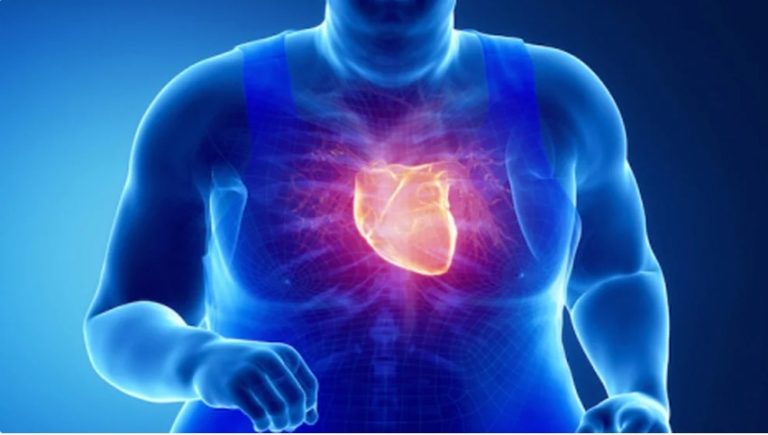 La obesidad dificulta el diagnóstico de las enfermedades cardiovasculares