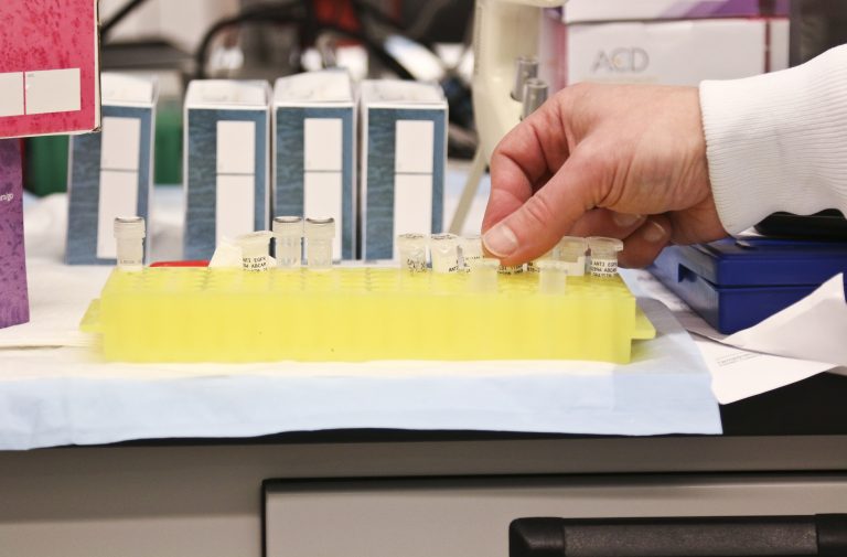 El cáncer de próstata es el más frecuente en Latinoamérica y el Caribe