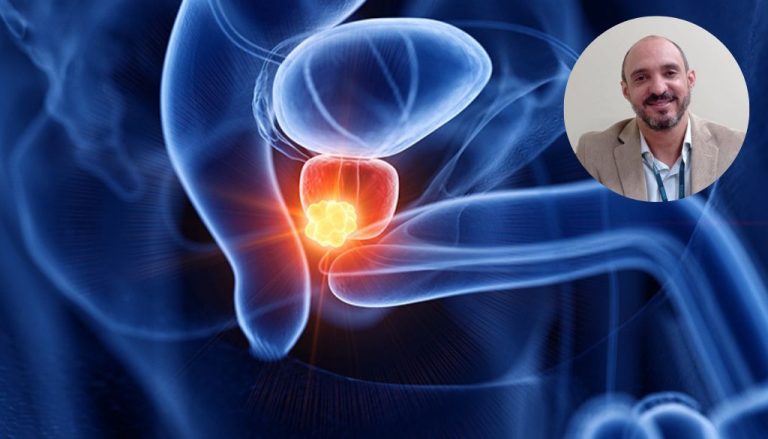 Urólogo alerta sobre el cáncer de próstata